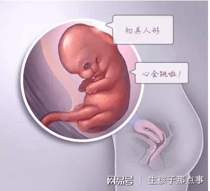 无精症
